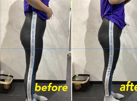 トレーニングによる女性のヒップラインの変化。左がトレーニング前、右がトレーニング後。